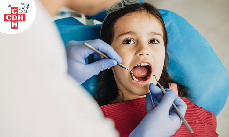 When to take your child for a Root Canal