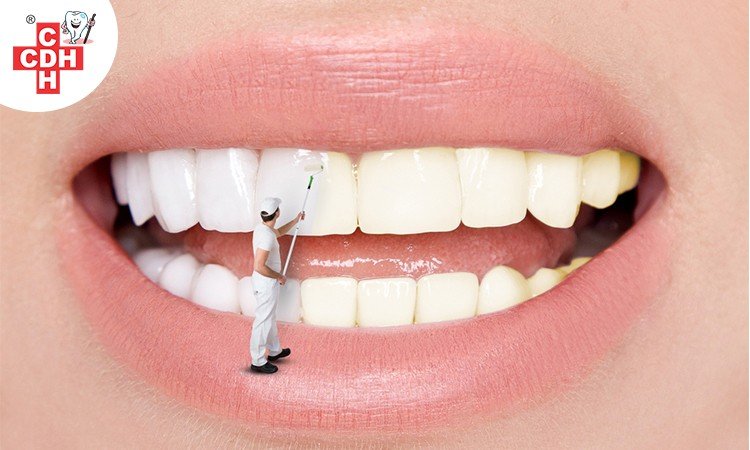 Better appearance and oral health