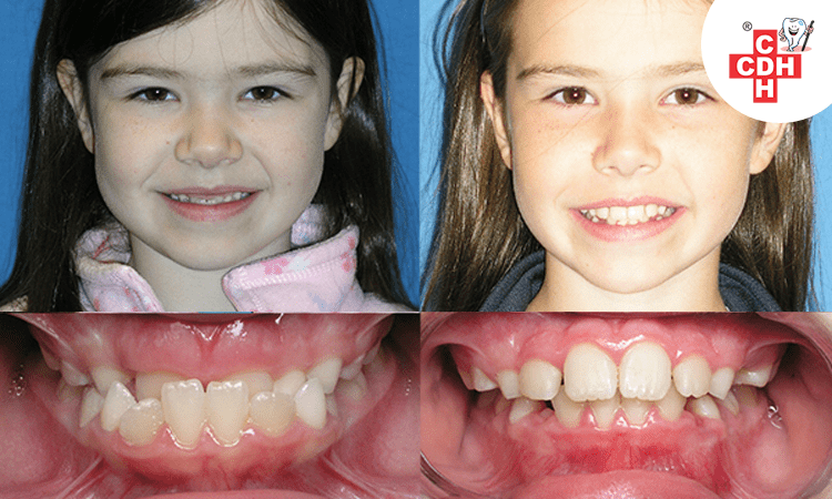 When is the right time to take my child to visit an orthodontist?