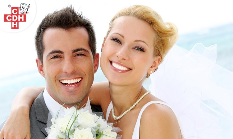 5 tips to have a perfect smile on your wedding day