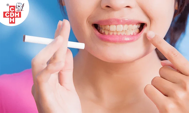 Can smoking causes yellowing of your teeth