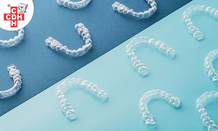 Facts you almost certainly did't realize the invisible aligners