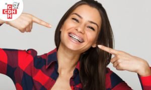 Here is what you should know before getting braces