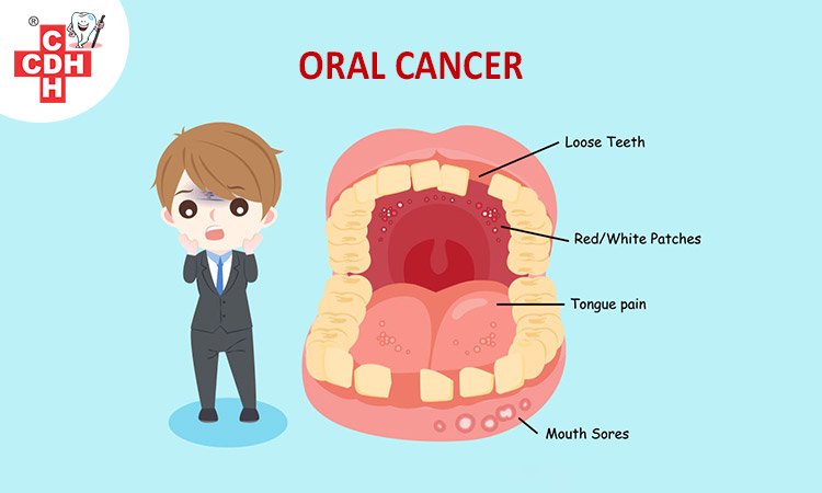 Ultimate Guide about oral and maxillofacial surgery