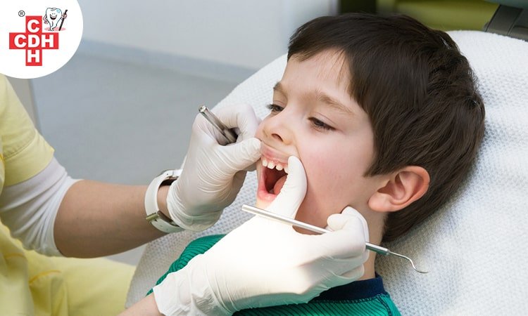 Tooth decay in baby teeth the cause