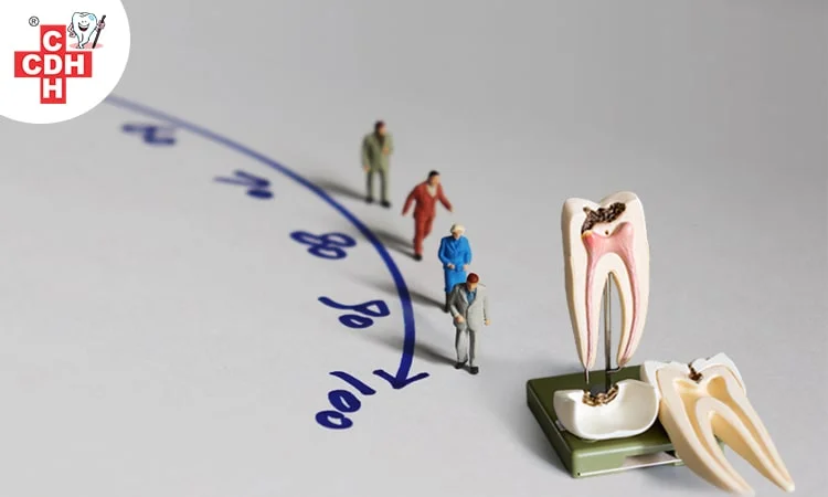 Age for Root canal Treatment