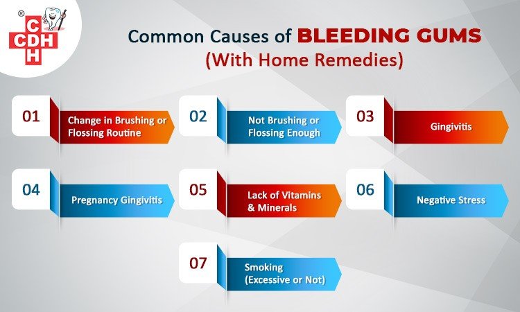 Common Causes of bleeding Gums With Home Remedies