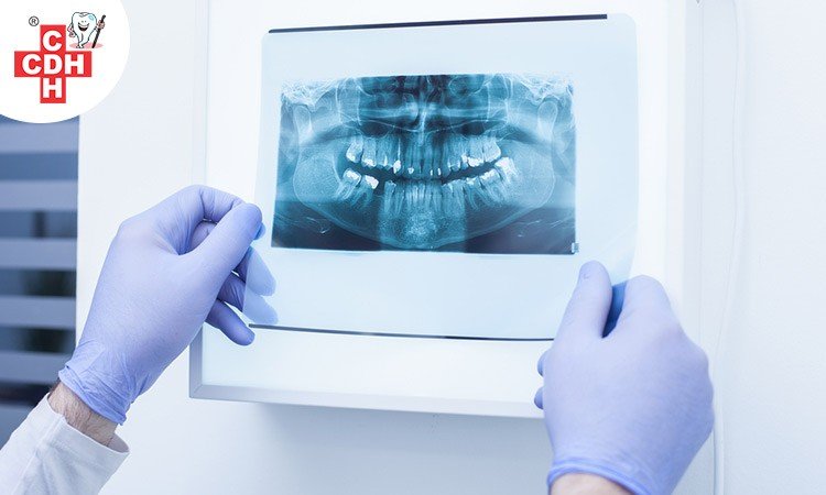 Dental X-rays are Diagnostic and Preventive