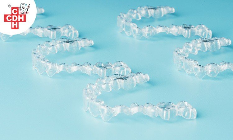 Invisible aligners cost in india