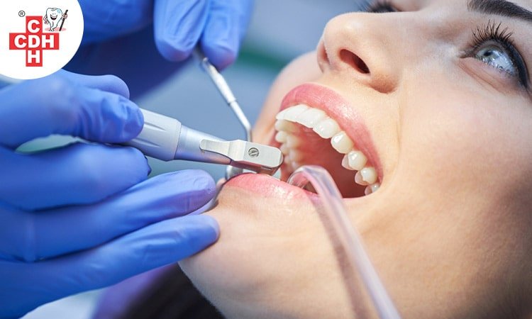 Professional Teeth Cleaning in Rajkot