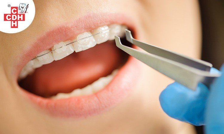 orthodontic treatment in gujarat