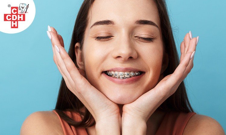 Benefits of Orthodontic Treatment