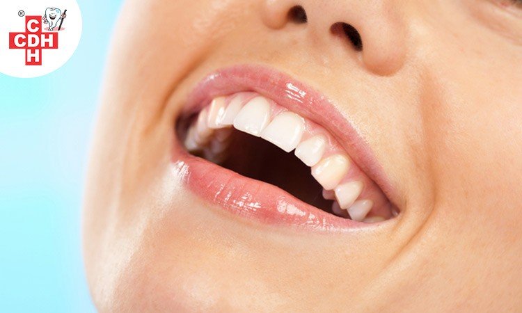 Benefits of a Smile Makeover