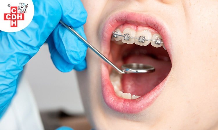 orthodontic treatment in rajkot