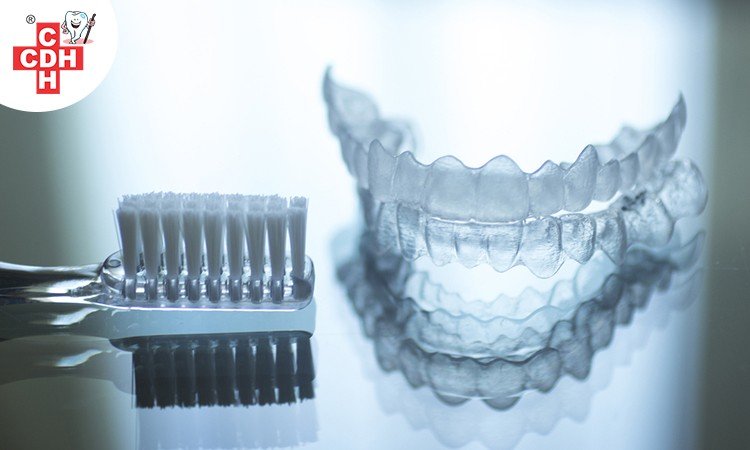 Invisible Aligners Cleaning