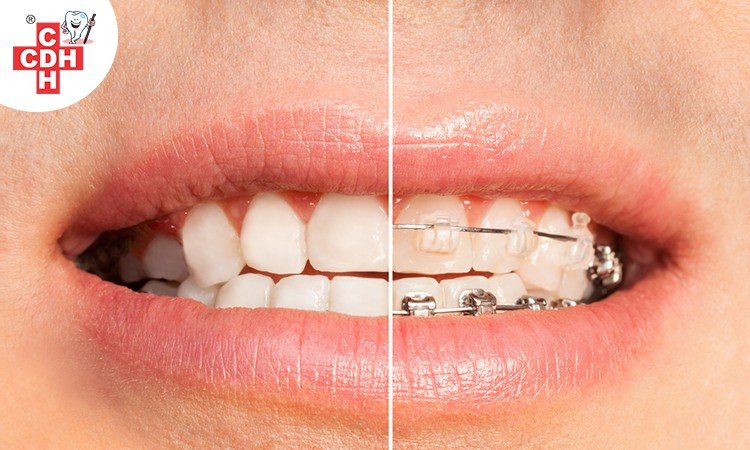 Difference between Dentist and Orthodontist