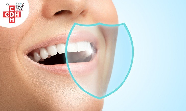 Effects of Dental Veneers on oral health