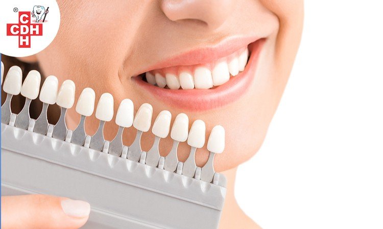 cosmetic dentistry in rajkot