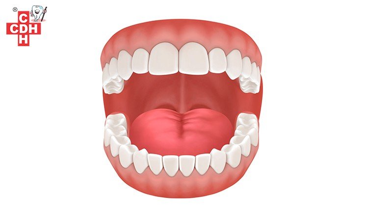 What are Dentures and how do dentures work