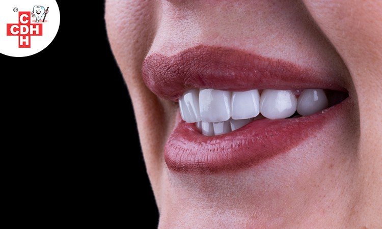 Why Digital Smile Design is flared-up