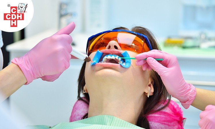 Teeth Whitening Types Procedures Pros And Cons 