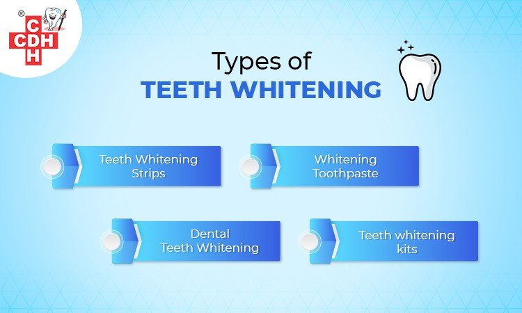 Types of Teeth Whitening