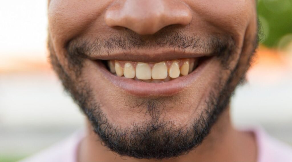 Close-up of a smiling man's face with yellow teeth, illustrating the need for a smile makeover. The dentist explains the cost of a smile makeover in India.