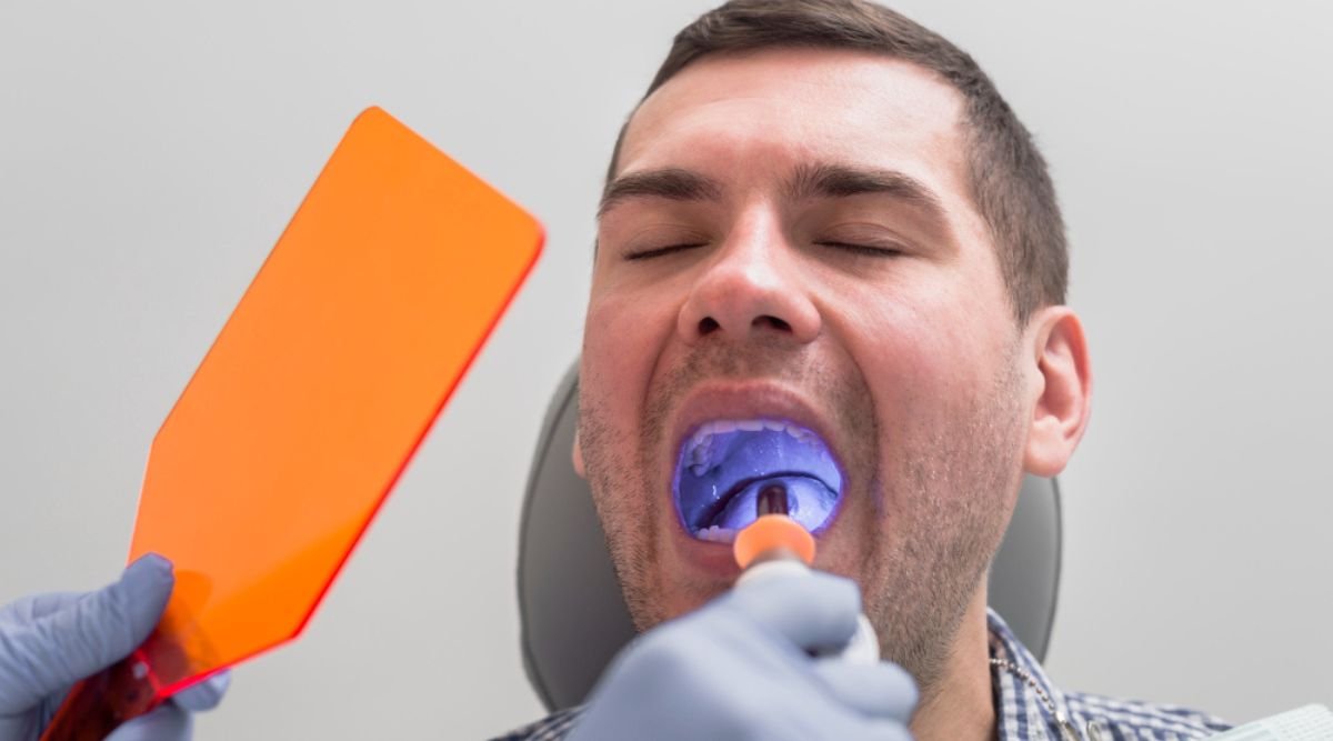 Patient Getting Dental Sealants Applied at City Dental Hospital