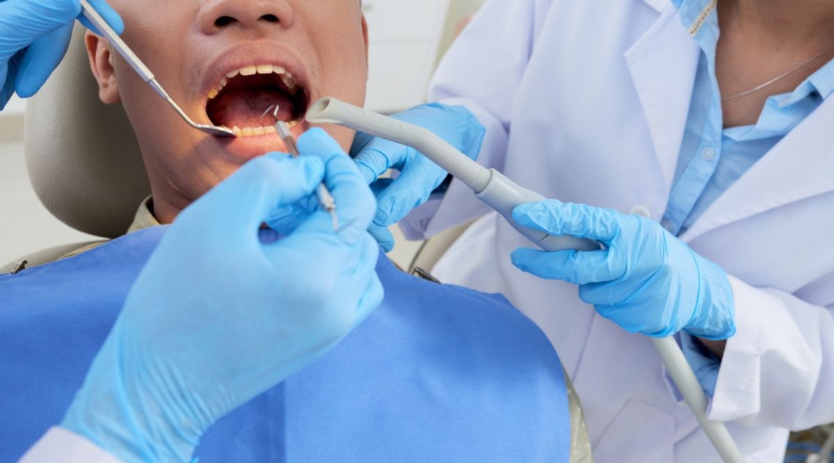 Dental Sealants Application for Tooth Protection at Dentist Office and explained about dental sealants cost in india