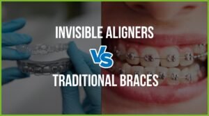 Invisible Aligners vs Traditional Braces: Cost Comparison India