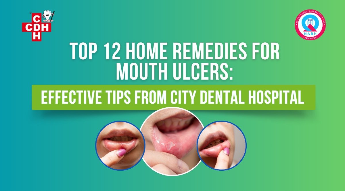 Top 12 Home Remedies for Mouth Ulcers