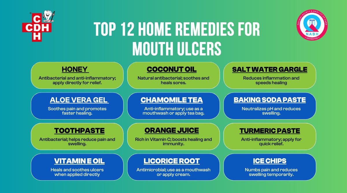 Top 12 Home Remedies for Mouth Ulcers1